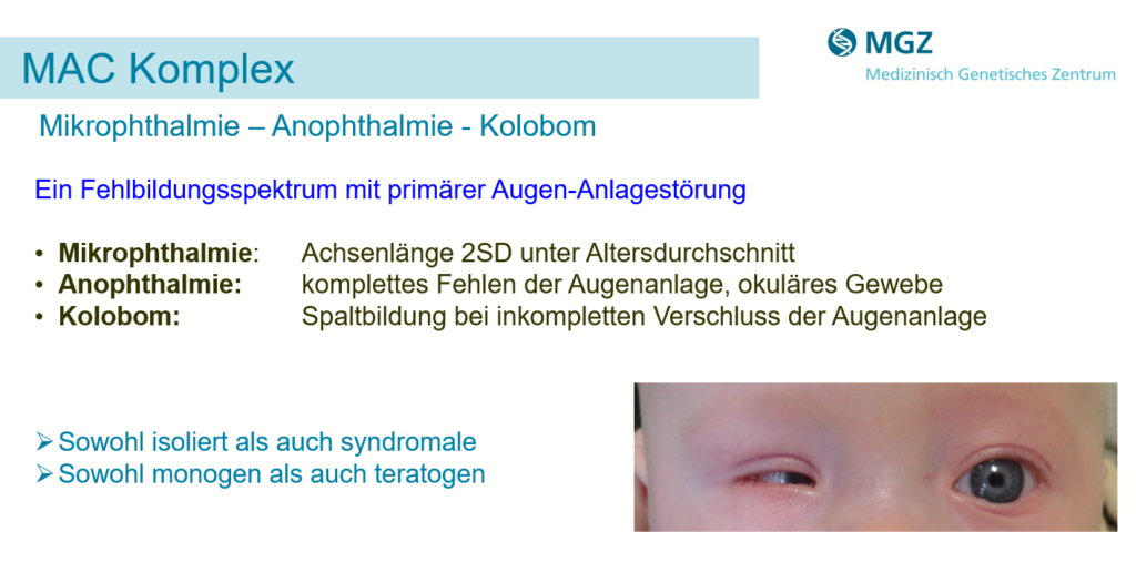Webinar Genetik angeborener Augenfehlbildungen